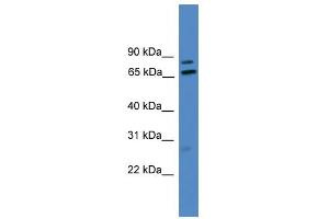 WB Suggested Anti-LRRFIP1 Antibody Titration: 0. (LRRFIP1 antibody  (Middle Region))