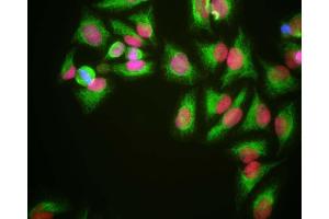 HeLa cells grown in tissue culture and stained with ABIN1580427 (red), chicken polyclonal antibody to Vimentin CPCA-VIM (green) and DNA (blue).