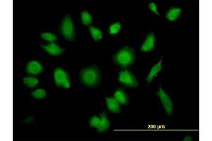 Immunofluorescence of purified MaxPab antibody to TTC1 on HeLa cell. (TTC1 antibody  (AA 1-292))