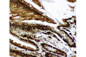 IHC-P: p73 antibody testing of mouse intestine tissue (Tumor Protein p73 antibody  (AA 1-198))