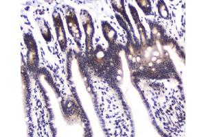 IHC analysis of DGCR8 using anti-DGCR8 antibody (ABIN5692841). (DGCR8 antibody  (AA 561-762))