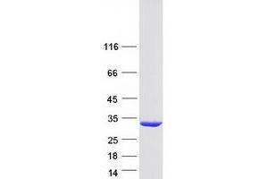 Validation with Western Blot (GSTM5 Protein (Myc-DYKDDDDK Tag))