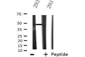 Western blot analysis of extracts from 293 cells using CSTF1 antibody. (CSTF1 antibody  (N-Term))