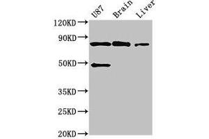 Western Blot Positive WB detected in: U87 whole cell lysate, Mouse brain tissue, Mouse liver tissue All lanes: GARS antibody at 3 μg/mL Secondary Goat polyclonal to rabbit IgG at 1/50000 dilution Predicted band size: 84 kDa Observed band size: 84 kDa (GARS antibody  (AA 1-389))
