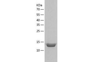 Western Blotting (WB) image for Cellular Retinoic Acid Binding Protein 2 (CRABP2) (AA 2-138) protein (His tag) (ABIN7285886) (CRABP2 Protein (AA 2-138) (His tag))