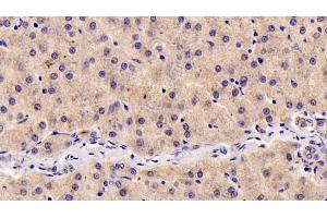 Detection of IGF1 in Human Liver Tissue using Monoclonal Antibody to Insulin Like Growth Factor 1 (IGF1)