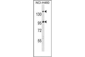 Western blot analysis of SSC5D Antibody  in NCI-H460 cell line lysates (35ug/lane). (SSC5D antibody  (Middle Region))