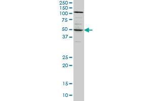 SYT4 monoclonal antibody (M04A), clone 5F8 Western Blot analysis of SYT4 expression in A-431 . (SYT4 antibody  (AA 1-99))