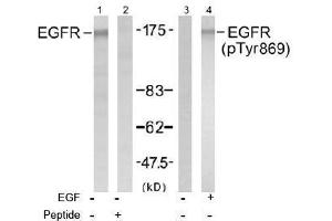 Image no. 1 for anti-Epidermal Growth Factor Receptor (EGFR) (Tyr869) antibody (ABIN197464) (EGFR antibody  (Tyr869))