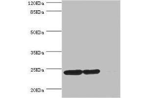 Western blot All lanes: DTYMK antibody at 5. (DTYMK antibody  (AA 1-212))