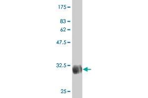 Western Blot detection against Immunogen (31. (SLC46A2 antibody  (AA 227-282))