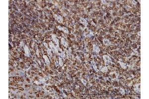 Immunoperoxidase of monoclonal antibody to HCLS1 on formalin-fixed paraffin-embedded human tonsil. (HCLS1 antibody  (AA 266-355))