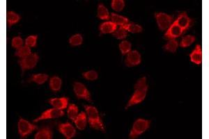 ABIN6269104 staining HepG2 by IF/ICC. (CDK1 antibody  (N-Term))