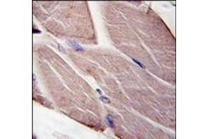 Formalin-fixed and paraffin-embedded human skeletal muscle tissue reacted with PDK4, which was peroxidase-conjugated to the secondary antibody, followed by DAB staining. (PDK4 antibody  (Middle Region))