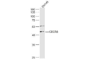 DU145 lysates probed with CECR6 Polyclonal Antibody, Unconjugated  at 1:500 dilution and 4˚C overnight incubation.