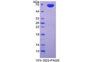 SDS-PAGE (SDS) image for Carboxypeptidase A3 (Mast Cell) (CPA3) (AA 110-417) protein (His tag,GST tag) (ABIN2122546)