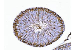 IHC analysis of TRBP/TARBP2 using anti-TRBP/TARBP2 antibody (ABIN7600548). (TARBP2 antibody  (AA 20-366))