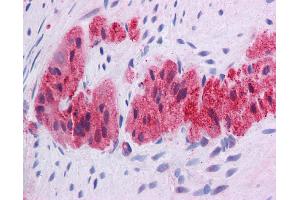 Immunohistochemistry with Human Colon, myenteric plexus