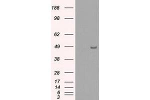 HEK293T cells were transfected with the pCMV6-ENTRY control (Left lane) or pCMV6-ENTRY IRF3 (Right lane) cDNA for 48 hrs and lysed. (IRF3 antibody)