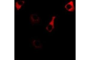 Immunofluorescent analysis of RPS14 staining in MCF7 cells. (RPS14 antibody)