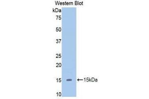 Western Blotting (WB) image for anti-Slit Homolog 2 (Drosophila) (SLIT2) (AA 1416-1528) antibody (ABIN1860579) (SLIT2 antibody  (AA 1416-1528))