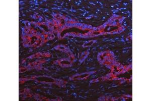 IF analysis of Cytokeratin 19 using anti-Cytokeratin 19 antibody (ABIN3043288). (Cytokeratin 19 antibody  (C-Term))