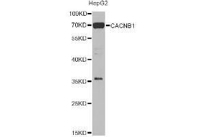 Western blot analysis of extracts of HepG2 cells, using CACNB1 Antibody (ABIN5975152) at 1/1000 dilution. (CACNB1 antibody)