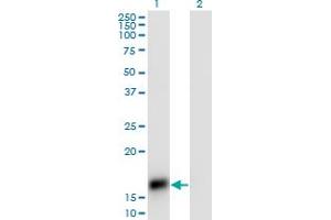 Western Blot analysis of CART expression in transfected 293T cell line by CART monoclonal antibody (M01), clone 3E4.