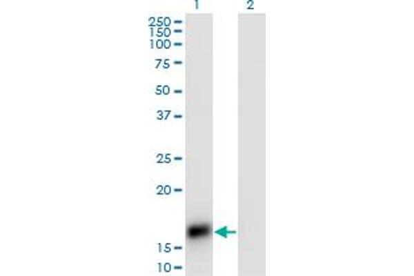 CARTPT Antikörper  (AA 1-116)
