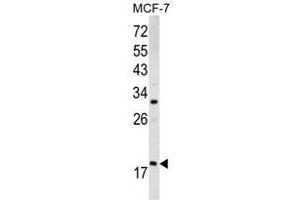 Image no. 1 for anti-ADP-Ribosylation Factor 3 (ARF3) (Middle Region) antibody (ABIN452754) (ARF3 antibody  (Middle Region))