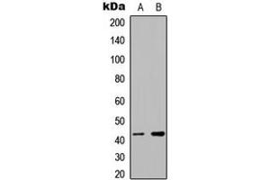 Western blot analysis of hnRNP G expression in Jurkat (A), RT4 (B) whole cell lysates. (RBMX antibody  (N-Term))