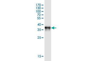 Western Blot detection against Immunogen (36. (MAPT antibody  (AA 167-266))