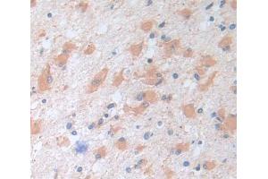 Used in DAB staining on fromalin fixed paraffin- embedded tissue (DARS antibody  (AA 363-501))