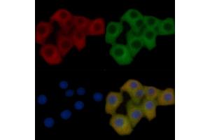 FAS Mouse Monoclonal Antibody staining Hela cells by IF/ICC.