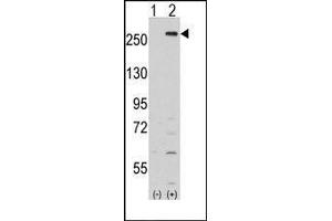 Western blot analysis of LMTK2 (arrow) using rabbit polyclonal LMTK2 Antibody (LMTK2 antibody  (Middle Region))