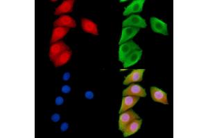 ABIN6266100 and ABIN6278545 staining Hela cells by IF/ICC. (ZNF598 antibody  (N-Term))
