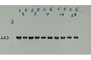 Crude homogenates of rat facial nucleus were run out on 7. (INA antibody)