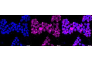 Immunocytochemical staining of Hela cells with PRKCSH antibody (ABIN7799984), 1:1,000).