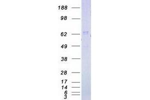 Validation with Western Blot