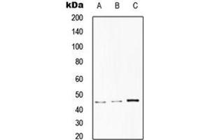 Western blot analysis of CD75 expression in HepG2 (A), HeLa (B), RAW264. (ST6GAL1 antibody  (Center))