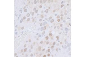 Immunohistochemistry (IHC) image for anti-RNA Polymerase-Associated Protein CTR9 Homolog (CTR9) (AA 1123-1173) antibody (ABIN7453428)