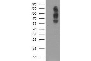 HEK293T cells were transfected with the pCMV6-ENTRY control (Left lane) or pCMV6-ENTRY SLC7A8 (Right lane) cDNA for 48 hrs and lysed. (SLC7A8 antibody)