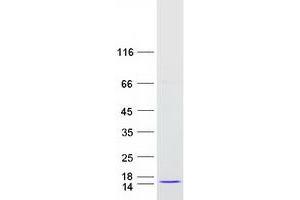 Validation with Western Blot