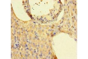 Immunohistochemistry of paraffin-embedded human testis tissue using ABIN7157130 at dilution of 1:100 (ISPD antibody  (AA 1-264))