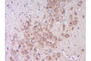 Paraformaldehyde-fixed, paraffin embedded Rat brain Antigen retrieval by boiling in sodium citrate buffer (pH6. (EIF4B antibody  (pSer406))