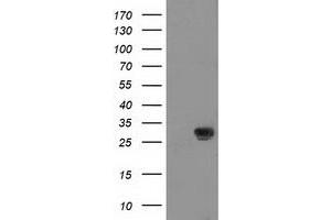 HEK293T cells were transfected with the pCMV6-ENTRY control (Left lane) or pCMV6-ENTRY NNMT (Right lane) cDNA for 48 hrs and lysed. (NNMT antibody)