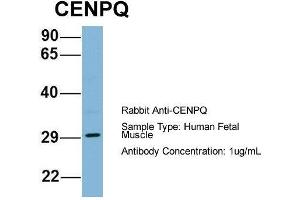 Host: Rabbit  Target Name: CENPQ  Sample Tissue: Human Fetal Muscle  Antibody Dilution: 1. (CENPQ antibody  (N-Term))