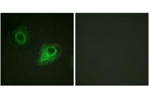 Immunofluorescence analysis of HeLa cells, using VEGFR2 (Ab-1054) Antibody.