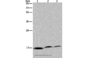 Western blot analysis of Jurkat, Hela and K562 cell, using NDUFAF4 Polyclonal Antibody at dilution of 1:350