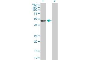 Western Blot analysis of UBASH3A expression in transfected 293T cell line by UBASH3A MaxPab polyclonal antibody.